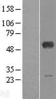 Human ALDH6A1 Protein (Over-Expression Lysate Myc-DDK (Flag))