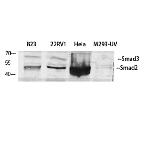SMAD2+3 Antibody (1-80 aa)