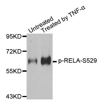 RELA / NFKB p65 Antibody (phospho-Ser529)