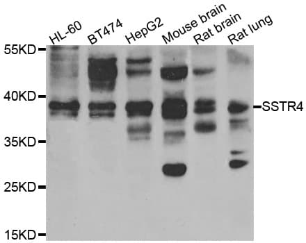 SSTR4 Antibody