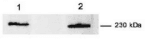 Monoclonal Mouse anti-Human MYOF / Myoferlin Antibody (clone 7D2, WB)