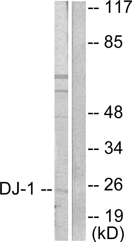 Polyclonal Rabbit anti-Human PARK7 / DJ-1 Antibody (aa21-70, IHC, IF, WB)