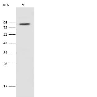 PAK6 Antibody