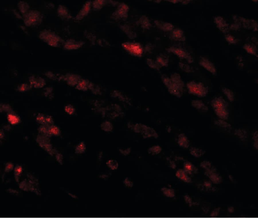 IHC-plus™ CRACR2A / EFCAB4B Antibody