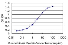 Monoclonal Mouse anti-Human E2F4 Antibody (clone 5B7, WB)