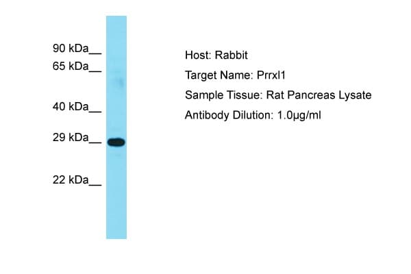 DRGX Antibody (aa101-150)