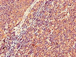 KIR2DS2 / CD158j Antibody