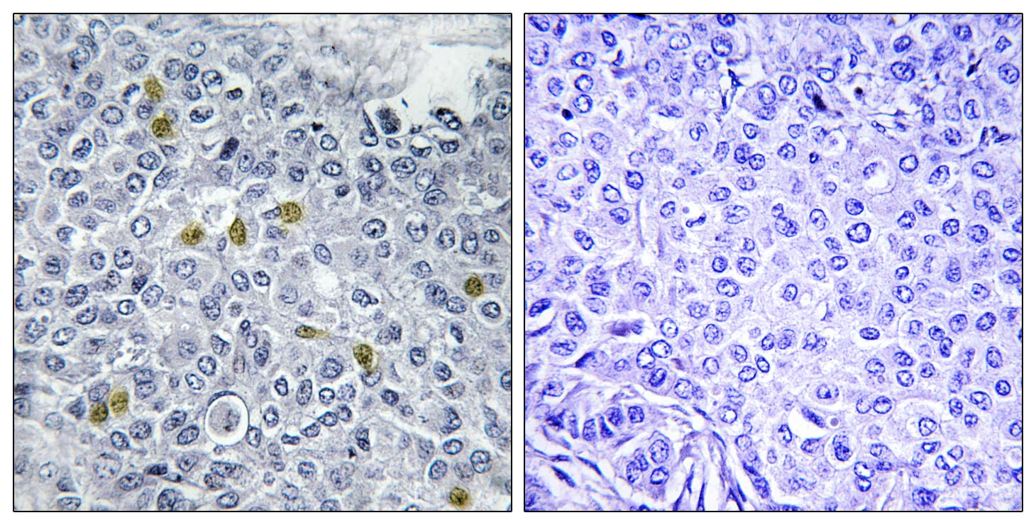 TOP2A / Topoisomerase II Alpha Antibody (phospho-Ser1106)