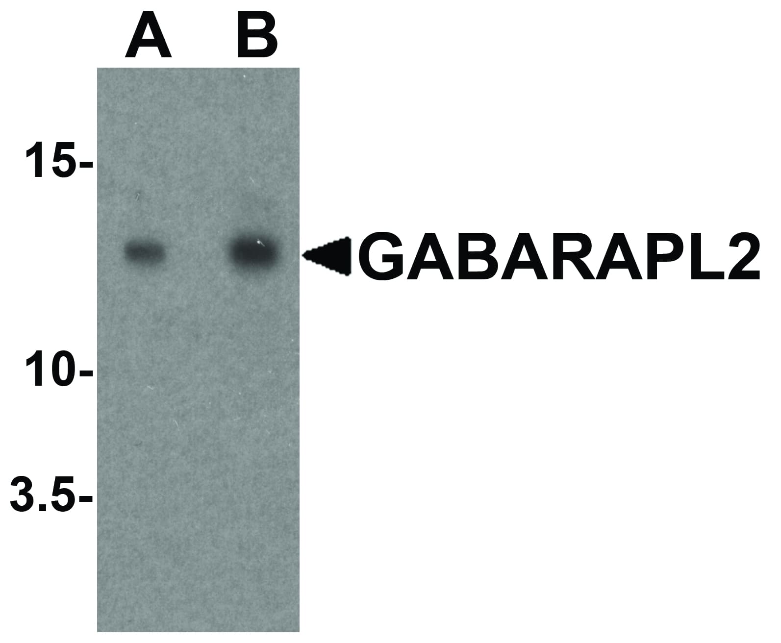 IHC-plus™ Polyclonal Rabbit anti-Human GABARAPL2 / ATG8 Antibody (IHC, IF, WB)