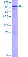 Human RBBP5 Protein (Recombinant GST)