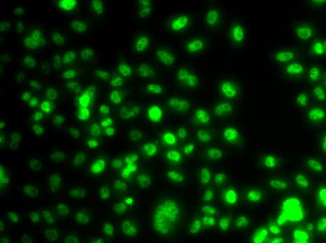 Polyclonal Rabbit anti-Human PAX6 Antibody (IHC, IF, WB)