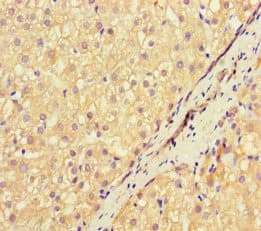 NEU1 / NEU Antibody