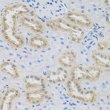 HPS / HPS1 Antibody