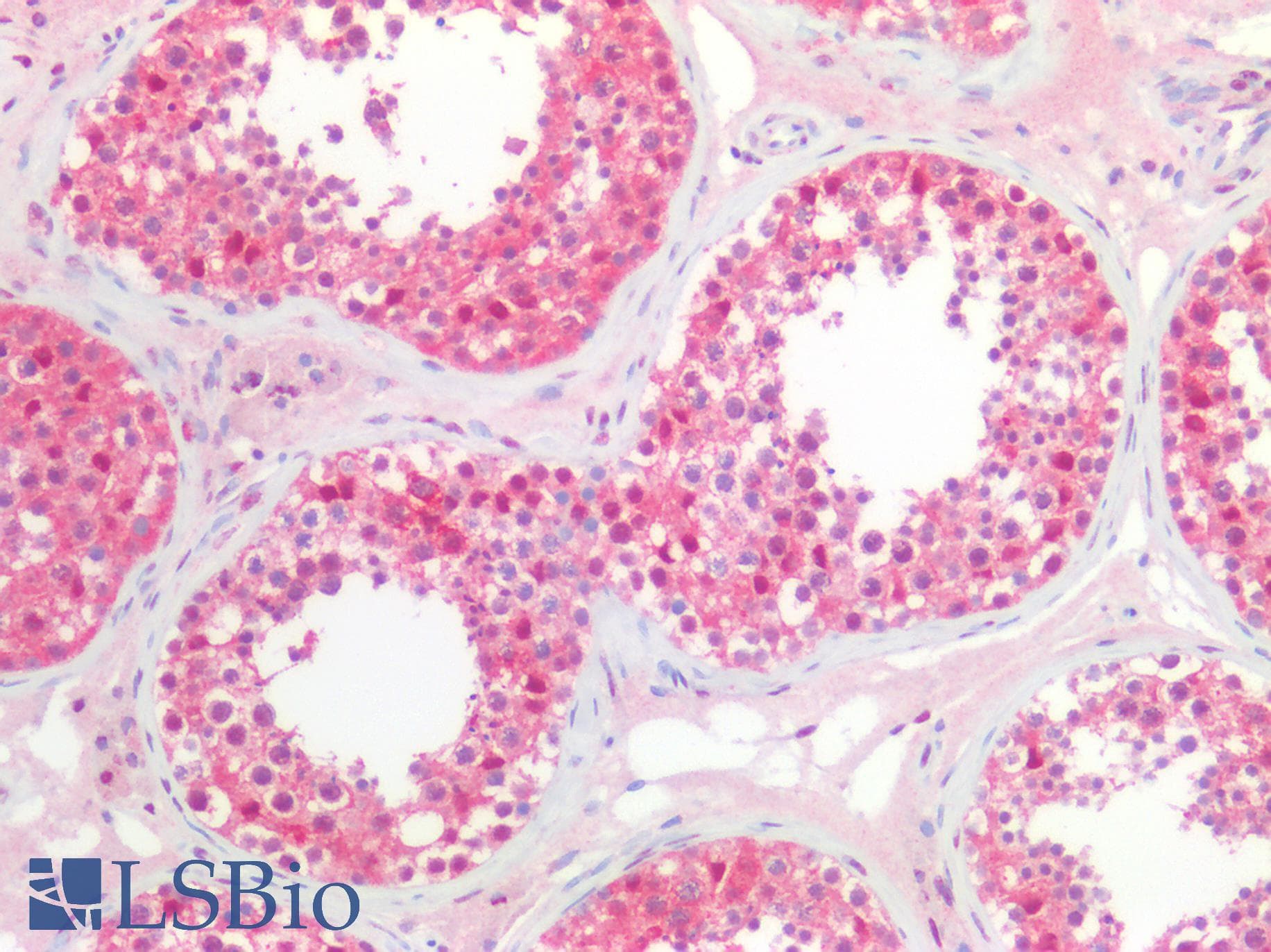 IHC-plus™ Polyclonal Rabbit anti-Human NEDD8 Antibody (IHC)