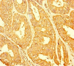 Polyclonal Rabbit anti-Human CHTOP / FOP Antibody (IHC, WB)