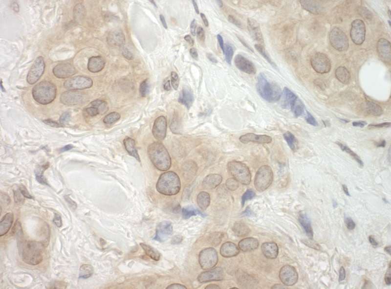 CASC3 / MLN51 Antibody (aa653-703)