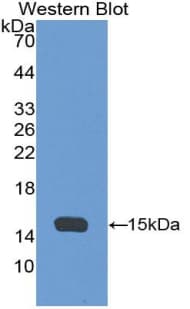 AHSP / EDRF Antibody (aa2-102)