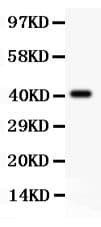 Tuberin / TSC2 Antibody (aa1611-1807)