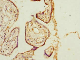 Polyclonal Rabbit anti-Human PHLDA2 / TSSC3 Antibody (IHC)