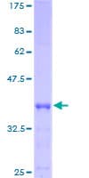 Human ACYP1 Protein (Recombinant GST)