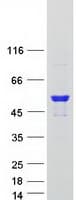 Human ARHGAP1 / CDC42GAP Protein (Recombinant Myc-DDK (Flag))