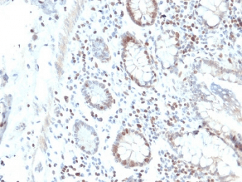 RAD51 / RECA Antibody (clone RAD51/2702)