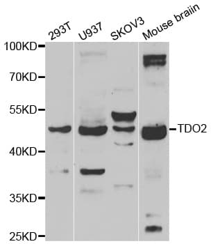 Polyclonal Rabbit anti-Human TDO2 Antibody (IHC, WB)