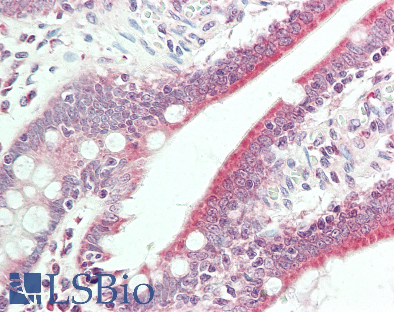 BMP6 Antibody (HRP)