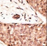 CDX2 Antibody (aa1-30)