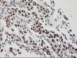 RAP74 / GTF2F1 Antibody (clone OTI4B10)