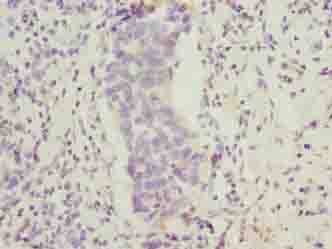 FAM222B Antibody