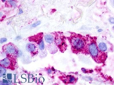IHC-plus™ UTS2R / GPR14 Antibody (Cytoplasmic Domain)