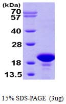 Human PFDN2 Protein (Recombinant His)