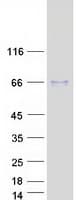 Human ATCAY / CLAC Protein (Recombinant Myc-DDK (Flag))