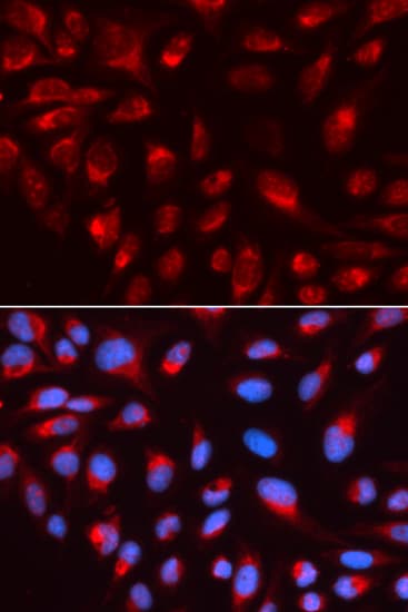 CTBP1 / CTBP Antibody