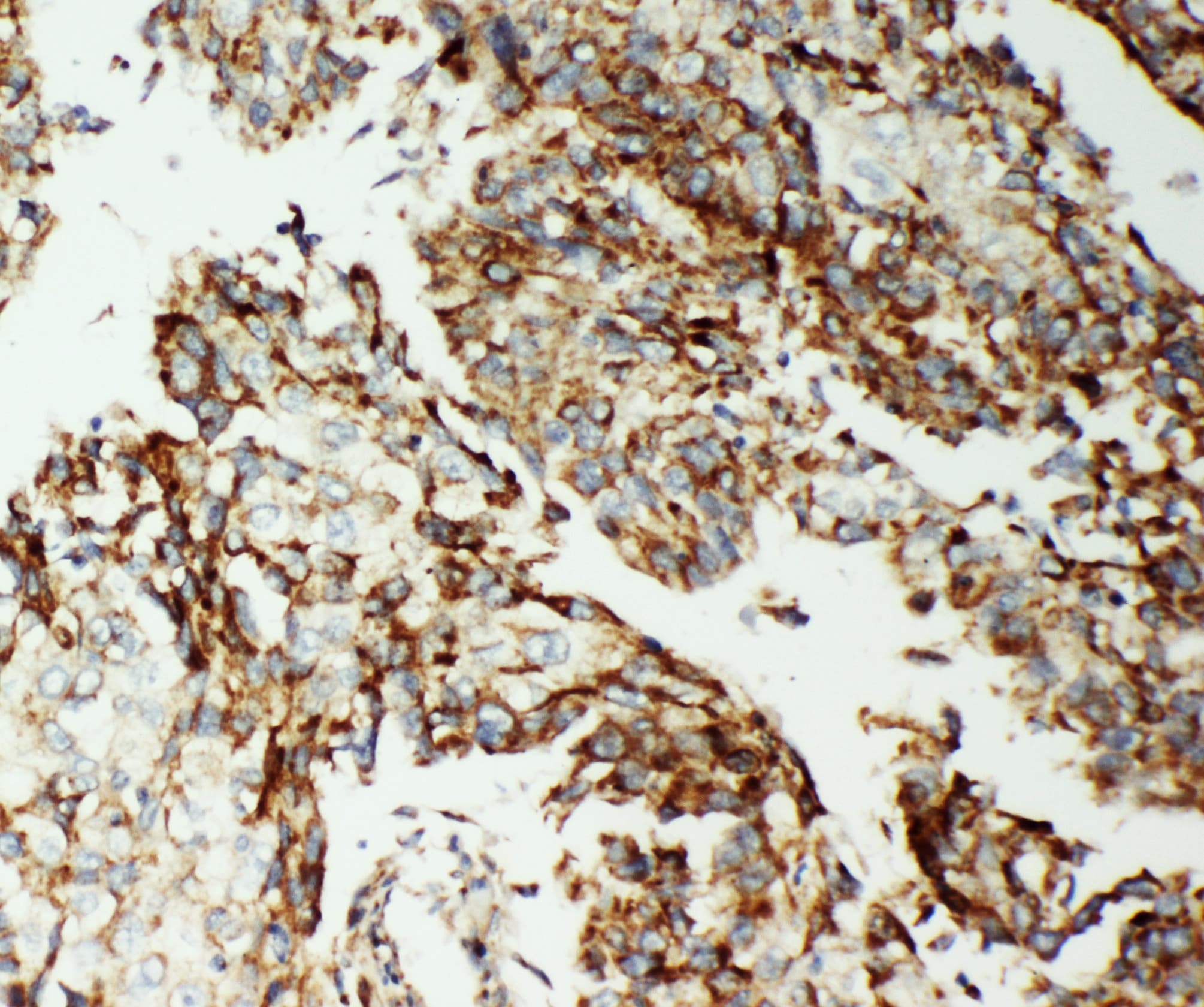Polyclonal Rabbit anti-Human AIFM1 / AIF / PDCD8 Antibody (aa596-613, IHC, WB)