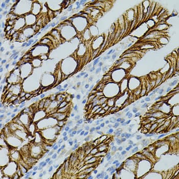 CLDN3 / Claudin 3 Antibody