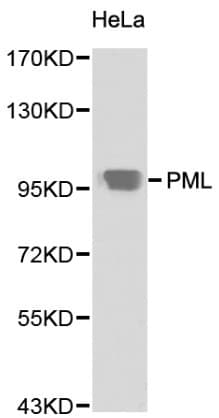 Polyclonal Rabbit anti-Human PML Antibody (IHC, WB)