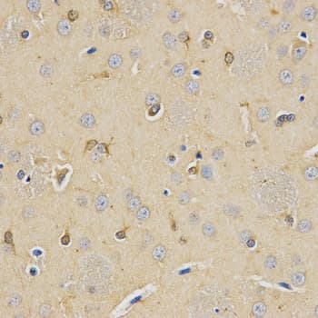 CPE / Carboxypeptidase E Antibody