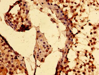 HIF2A / EPAS1 Antibody