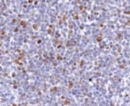 MKI67 / Ki67 Antibody (Internal)