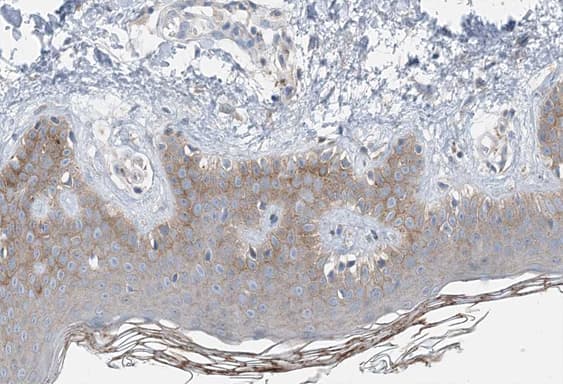 Polyclonal Rabbit anti-Human COL14A1 / Collagen XIV Antibody (IHC, IF, WB)