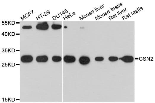 CSN2 / Beta Casein Antibody