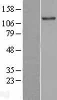 TLL2 Protein (Over-Expression Lysate Myc-DDK (Flag))
