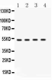 BDKRB2/Bradykinin B2 Receptor Antibody