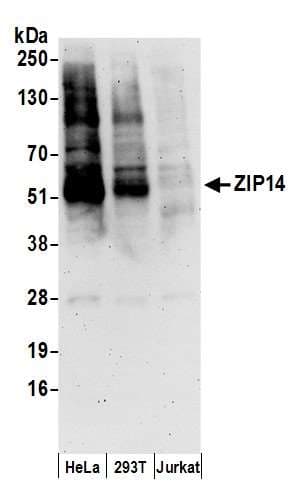 SLC39A14 / ZIP14 Antibody (aa50-100)