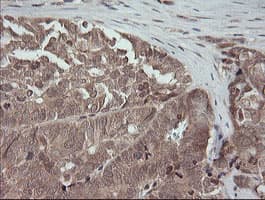MAP2K3 / MEK3 / MKK3 Antibody (clone OTI5G5)