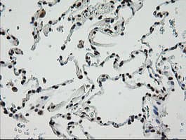 ZSCAN18 / ZNF447 Antibody (clone OTI2H7, Carrier-free)