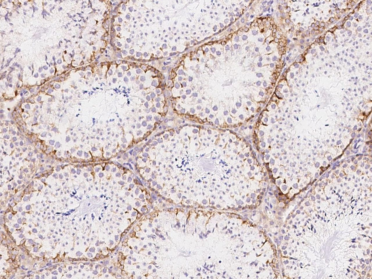 Polyclonal Rabbit anti-Mouse IGF2R / CD222 Antibody (Preservative Free, IHC, WB)