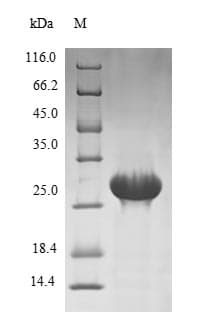 Human PRSS21 / Testisin Protein (Recombinant 6His, N-terminus)